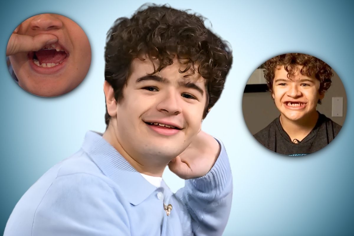 what happened to gaten matarazzo teeth