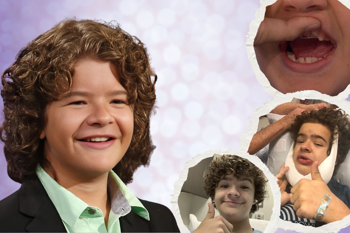 Gaten Matarazzo Teeth Surgery Journey