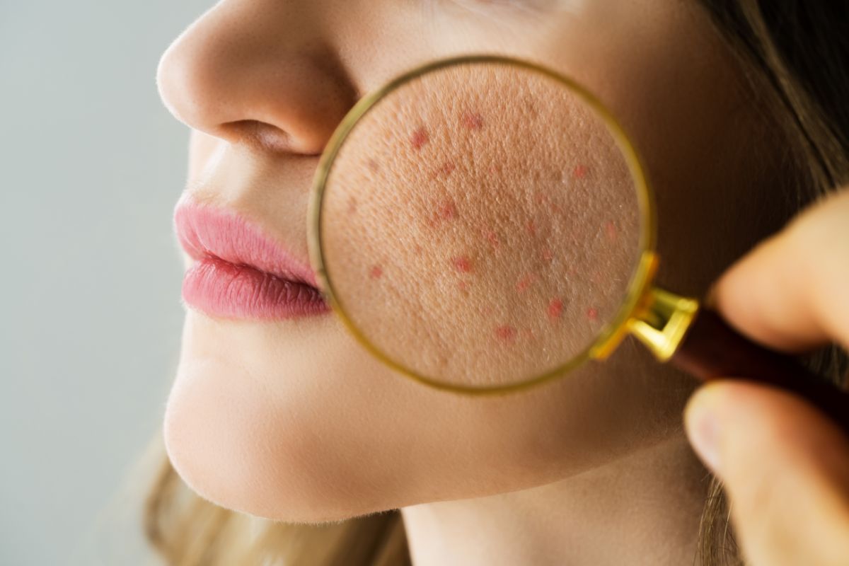 Managing the Skin Microbiome